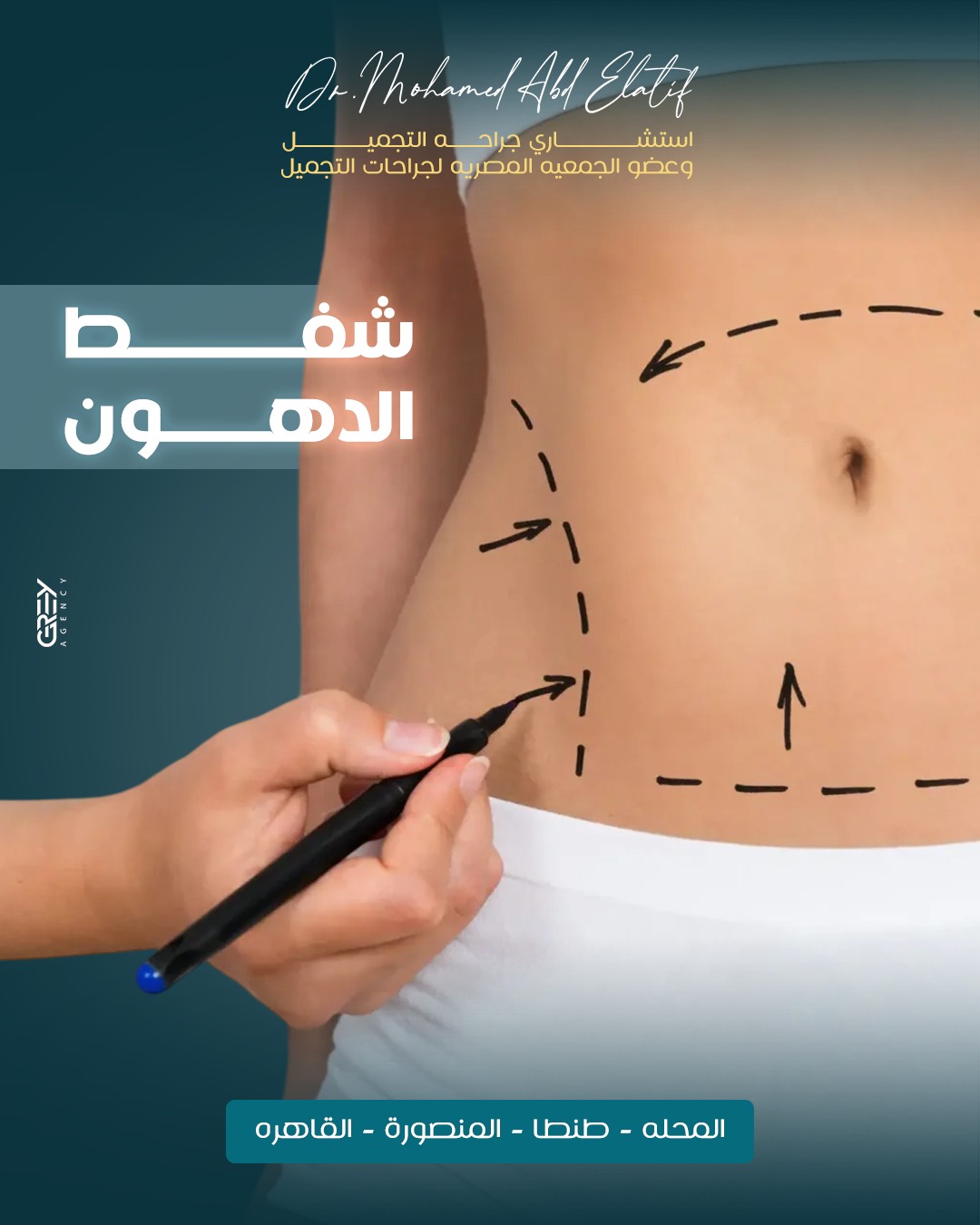 شفط الدهون