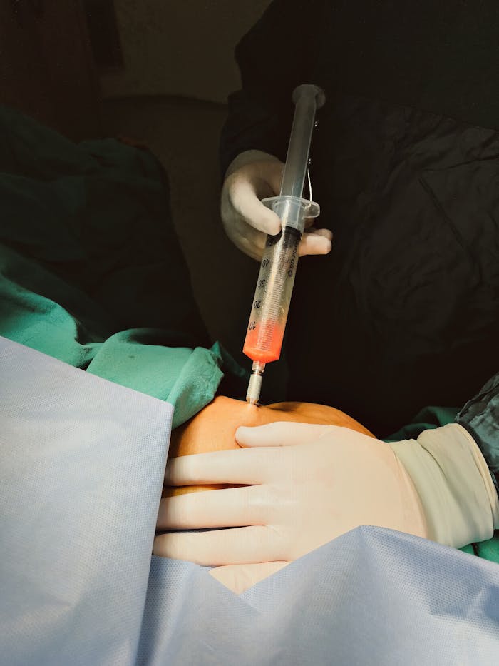 A close-up view of a liposuction procedure being performed with a syringe in a sterile operating room environment.